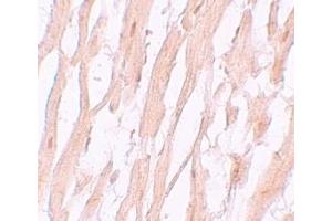 Immunohistochemistry (IHC) image for anti-ATG9 Autophagy Related 9 Homolog A (S. Cerevisiae) (ATG9A) (C-Term) antibody (ABIN1030264) (ATG9A 抗体  (C-Term))