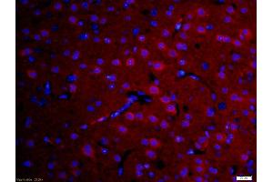 Formalin-fixed and paraffin-embedded rat brain labeled with Anti-DFFB Polyclonal Antibody, Unconjugated (ABIN724085) 1:200, overnight at 4°C, The secondary antibody was Goat Anti-Rabbit IgG, Cy3 conjugated used at 1:200 dilution for 40 minutes at 37°C.