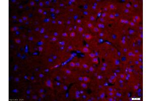 Formalin-fixed and paraffin-embedded rat brain labeled with Anti-DFFB Polyclonal Antibody, Unconjugated (ABIN724085) 1:200, overnight at 4°C, The secondary antibody was Goat Anti-Rabbit IgG, Cy3 conjugated used at 1:200 dilution for 40 minutes at 37°C. (DFFB 抗体  (AA 201-260))