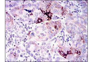Immunohistochemistry (IHC) image for anti-Secreted phosphoprotein 1 (SPP1) (AA 167-314) antibody (ABIN1845756) (Osteopontin 抗体  (AA 167-314))
