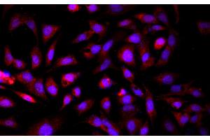 Immunofluorescence analysis of HepG2 cells using GCK Polyclonal Antibody at dilution of 1:100 (GCK 抗体)