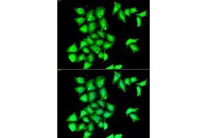Immunofluorescence analysis of HeLa cells using MSRB1 antibody (ABIN6129123, ABIN6144089, ABIN6144090 and ABIN6222462). (MSRB1 抗体  (AA 1-94))