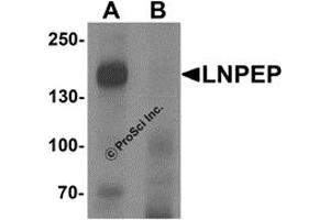 Western Blotting (WB) image for anti-Leucyl/cystinyl Aminopeptidase (LNPEP) (C-Term) antibody (ABIN1077382) (LNPEP 抗体  (C-Term))