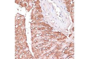 Immunohistochemistry (IHC) image for anti-Gem (Nuclear Organelle) Associated Protein 5 (GEMIN5) (AA 750-950) antibody (ABIN7267367)