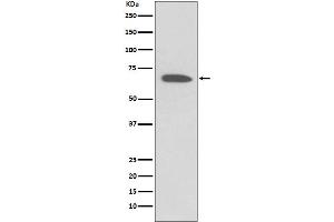 Western blot analysis of KCNA1 expression in Human fetal brain lysate.