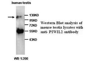 Image no. 1 for anti-Piwi-Like 2 (PIWIL2) (C-Term) antibody (ABIN791010) (PIWIL2 抗体  (C-Term))