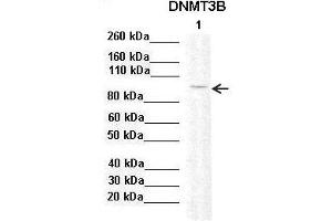 Sample Type :  Lane 1: 20ug mouse mesenchymal stem cell lysate  Primary Antibody Dilution :   1:2000  Secondary Antibody:  Anti-rabbit-HRP  Secondary Antibody Dilution:   1:10,000  Color/Signal Descriptions:  DNMT3B  Gene Name:  Anonymous  Submitted by: (DNMT3B 抗体  (Middle Region))