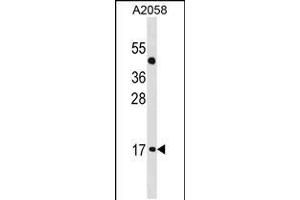 Western blot analysis in A2058 cell line lysates (35ug/lane). (ATOH7 抗体  (AA 85-112))