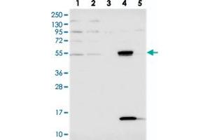 Western blot analysis of Lane 1: RT-4, Lane 2: U-251 MG, Lane 3: Human Plasma, Lane 4: Liver, Lane 5: Tonsil with UFSP2 polyclonal antibody  at 1:250-1:500 dilution. (UFSP2 抗体)