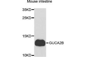 Western blot analysis of extracts of mouse small intestine, using GUCA2B antibody. (GUCA2B 抗体)