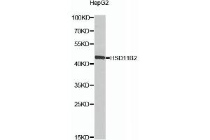 Western blot analysis of extracts of HepG2 cells, using HSD11B2 antibody (ABIN6129828, ABIN6142000, ABIN6142001 and ABIN6224104) at 1:1000 dilution. (HSD11B2 抗体  (AA 266-405))
