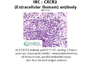 Image no. 1 for anti-Chemokine (C-X-C Motif) Receptor 2 (CXCR2) (2nd Extracellular Domain) antibody (ABIN1733394) (CXCR2 抗体  (2nd Extracellular Domain))