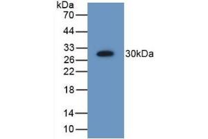 Detection of Recombinant PSMD9, Human using Polyclonal Antibody to Proteasome 26S Subunit, Non ATPase 9 (PSMD9) (Proteasome 26S Subunit, Non ATPase 9 (AA 2-223) 抗体)