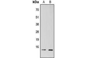 Western blot analysis of TAF13 expression in HEK293T (A), H9C2 (B) whole cell lysates.