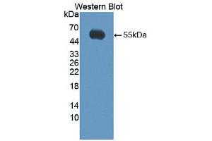 Western blot analysis of the recombinant protein. (Kallikrein 14 抗体  (AA 36-267))