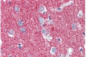 Human Brain, Cortex (formalin-fixed, paraffin-embedded) stained with SLC25A28 antibody ABIN462242 followed by biotinylated goat anti-rabbit IgG secondary antibody ABIN481713, alkaline phosphatase-streptavidin and chromogen. (SLC25A28 抗体  (AA 290-339))