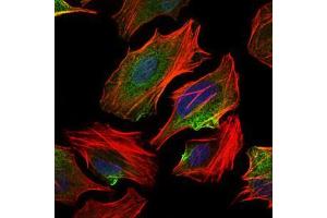 Immunofluorescence analysis of HeLa cells using ACLY mouse mAb (green). (ACLY 抗体  (AA 306-502))