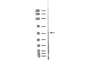 Western blot analysis of lysates from Rat liver, using Phospho-MLKL (Thr357) Antibody at 1/1000 dilution.