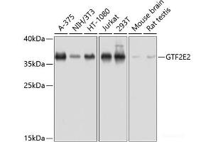 Western blot analysis of extracts of various cell lines using GTF2E2 Polyclonal Antibody at dilution of 1:1000. (GTF2E2 抗体)