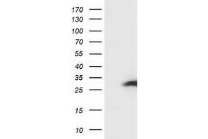 Image no. 4 for anti-Synovial Sarcoma, X Breakpoint 1 (SSX1) antibody (ABIN1501159) (SSX1 抗体)