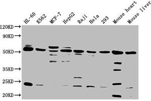 Western Blot Positive WB detected in: HL60 whole cell lysate, K562 whole cell lysate, MCF-7 whole cell lysate, HepG2 whole cell lysate, Raji whole cell lysate, Hela whole cell lysate, 293 whole cell lysate, Mouse heart tissue, Mouse liver tissue All lanes: NCR3LG1 antibody at 1:2000 Secondary Goat polyclonal to rabbit IgG at 1/50000 dilution Predicted band size: 51 kDa Observed band size: 51 kDa (B7-H6 抗体  (AA 25-262))