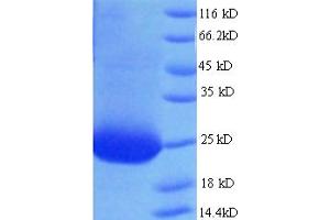SDS-PAGE (SDS) image for Cancer/testis Antigen 2 (CTAG2) (AA 1-210), (full length) protein (His-SUMO Tag) (ABIN4974391) (CTAG2 Protein (AA 1-210, full length) (His-SUMO Tag))