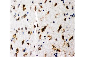 Anti-SHC antibody, IHC(P) IHC(P): Rat Brain Tissue