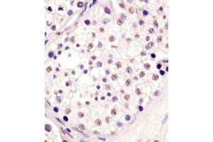(ABIN6242809 and ABIN6578637) staining MLL3 in human testis tissue sections by Immunohistochemistry (IHC-P - paraformaldehyde-fixed, paraffin-embedded sections). (MLL3 抗体  (N-Term))