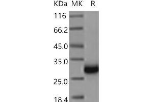 Western Blotting (WB) image for TIMP Metallopeptidase Inhibitor 1 (TIMP1) (Active) protein (ABIN7198249) (TIMP1 蛋白)