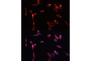 Immunofluorescence analysis of NIH/3T3 cells using MMP16 antibody (ABIN6132356, ABIN6143906, ABIN6143907 and ABIN6214654) at dilution of 1:100. (MMP16 抗体  (AA 290-565))