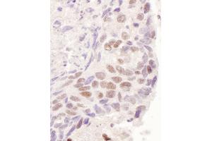 anti-GR (AA 1-50) antibody