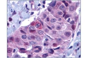 Image no. 1 for anti-BCL2 Binding Component 3 (BBC3) (N-Term) antibody (ABIN264889) (PUMA 抗体  (N-Term))