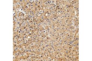 IHC analysis of Alpha 2-Antiplasmin/SERPINF2 using anti-Alpha 2-Antiplasmin/SERPINF2 antibody (ABIN7601808). (alpha 2 Antiplasmin 抗体  (AA 461-491))