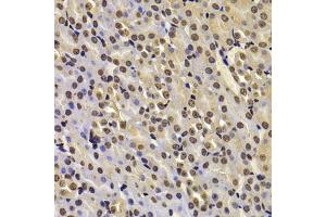 Immunohistochemistry of paraffin-embedded mouse kidney using FBXW7 antibody (ABIN5975397) at dilution of 1/100 (40x lens). (FBXW7 抗体)