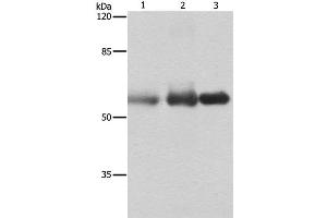 Western Blot analysis of Human cervical cancer, legs fibrous histiocytoma and fetal brain tissue using NECTIN1 Polyclonal Antibody at dilution of 1:400 (PVRL1 抗体)