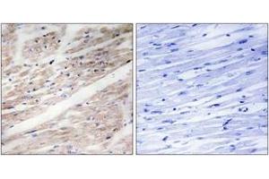 Immunohistochemistry (IHC) image for anti-Mast/stem Cell Growth Factor Receptor (KIT) (AA 906-955), (pTyr936) antibody (ABIN1531333)