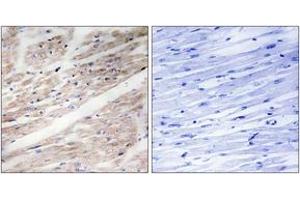 Immunohistochemistry analysis of paraffin-embedded human heart, using KIT (Phospho-Tyr936) Antibody. (KIT 抗体  (pTyr936))