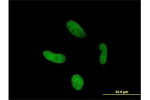 Immunofluorescence of purified MaxPab antibody to ZNF287 on HepG2 cell. (ZNF287 抗体  (AA 1-754))