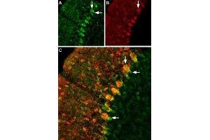 Expression of GABATR in rat cerebellum - Immunohistochemical staining of rat cerebellum using Anti-GABA Transporter 1 (GAT-1) (extracellular) Antibody (ABIN7043178, ABIN7044459 and ABIN7044460), (1:200). (SLC6A1 抗体  (2nd Extracellular Loop))