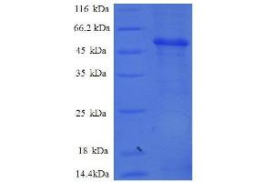 SDS-PAGE (SDS) image for Proteasome (Prosome, Macropain) Subunit, beta Type, 7 (PSMB7) (AA 44-275), (partial) protein (GST tag) (ABIN7479198)