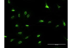 Immunofluorescence of monoclonal antibody to DLX3 on HeLa cell. (DLX3 抗体  (AA 1-287))