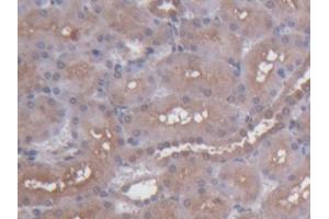 DAB staining on IHC-P; Samples: Rat Kidney Tissue (S100 Protein (S100) (AA 1-94) 抗体)