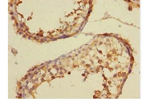 Immunohistochemistry of paraffin-embedded human testis tissue using ABIN7149072 at dilution of 1:100 (CSRNP2 抗体  (AA 324-543))