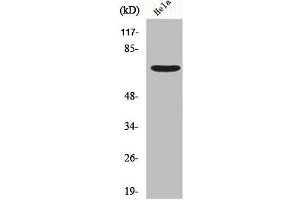 Western Blot analysis of Hela cells using Frizzled-1 Polyclonal Antibody (FZD1 抗体  (N-Term))