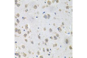 Immunohistochemistry of paraffin-embedded mouse brain using GNE antibody at dilution of 1:100 (x40 lens). (GNE 抗体)