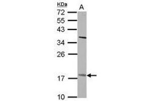 Image no. 2 for anti-Patatin-Like phospholipase Domain Containing 4 (PNPLA4) (AA 1-249) antibody (ABIN1500317) (PNPLA4 抗体  (AA 1-249))