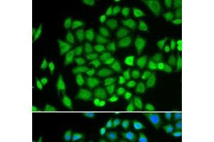 Immunofluorescence analysis of HeLa cells using AKR7A2 Polyclonal Antibody (AKR7A2 抗体)