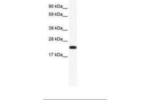 Image no. 1 for anti-Cbp/p300-Interacting Transactivator, with Glu/Asp-Rich Carboxy-terminal Domain, 4 (CITED4) (AA 31-80) antibody (ABIN202045) (CITED4 抗体  (AA 31-80))