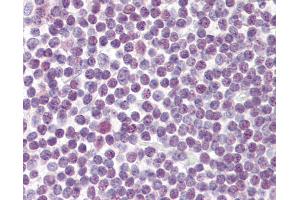 Anti-DDX18 antibody IHC of human tonsil. (DDX18 抗体  (AA 20-70))