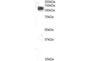 Western Blotting (WB) image for Cas-Br-M (Murine) Ecotropic Retroviral Transforming Sequence (CBL) peptide (ABIN369757) (Cas-Br-M (Murine) Ecotropic Retroviral Transforming Sequence (CBL) Peptide)